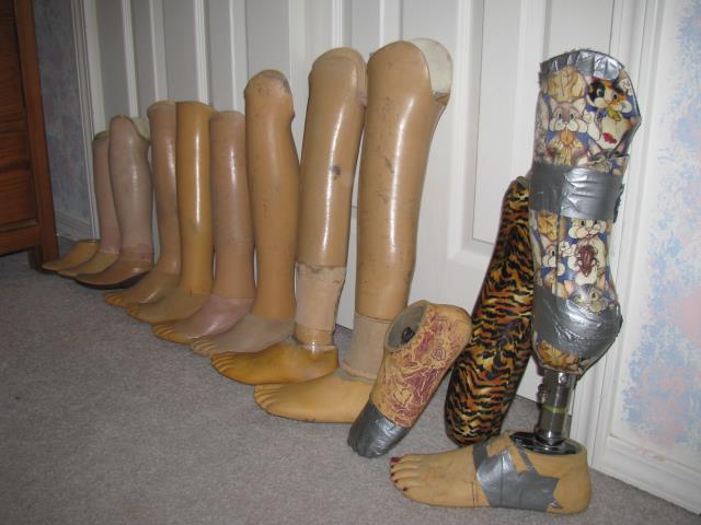 my legs from ages 3-14 lined up in a row