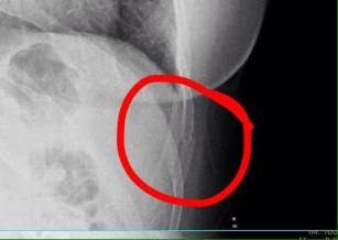 13690603_10207356806018581_4269798819142687243_n