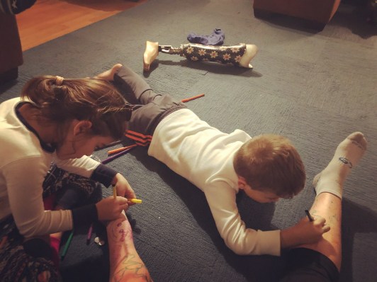 emily's niece and nephew drawing with markers on her legs. her prosthesis is on the floor in the background